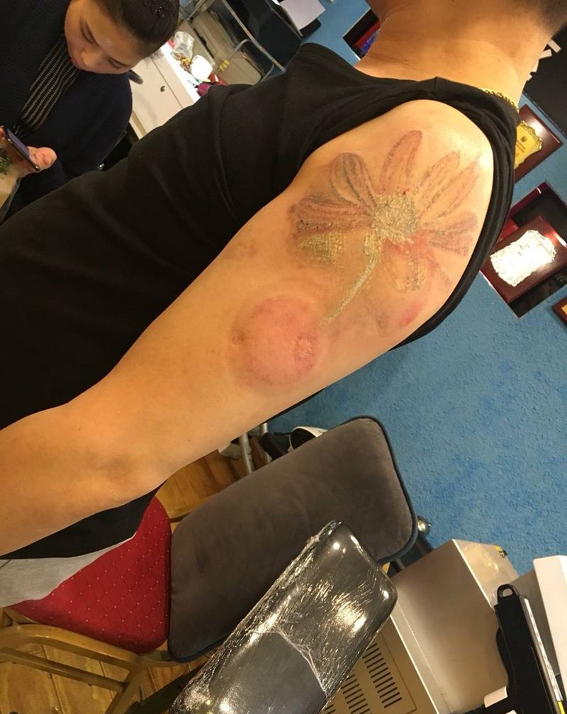 激光洗纹身纹身图片