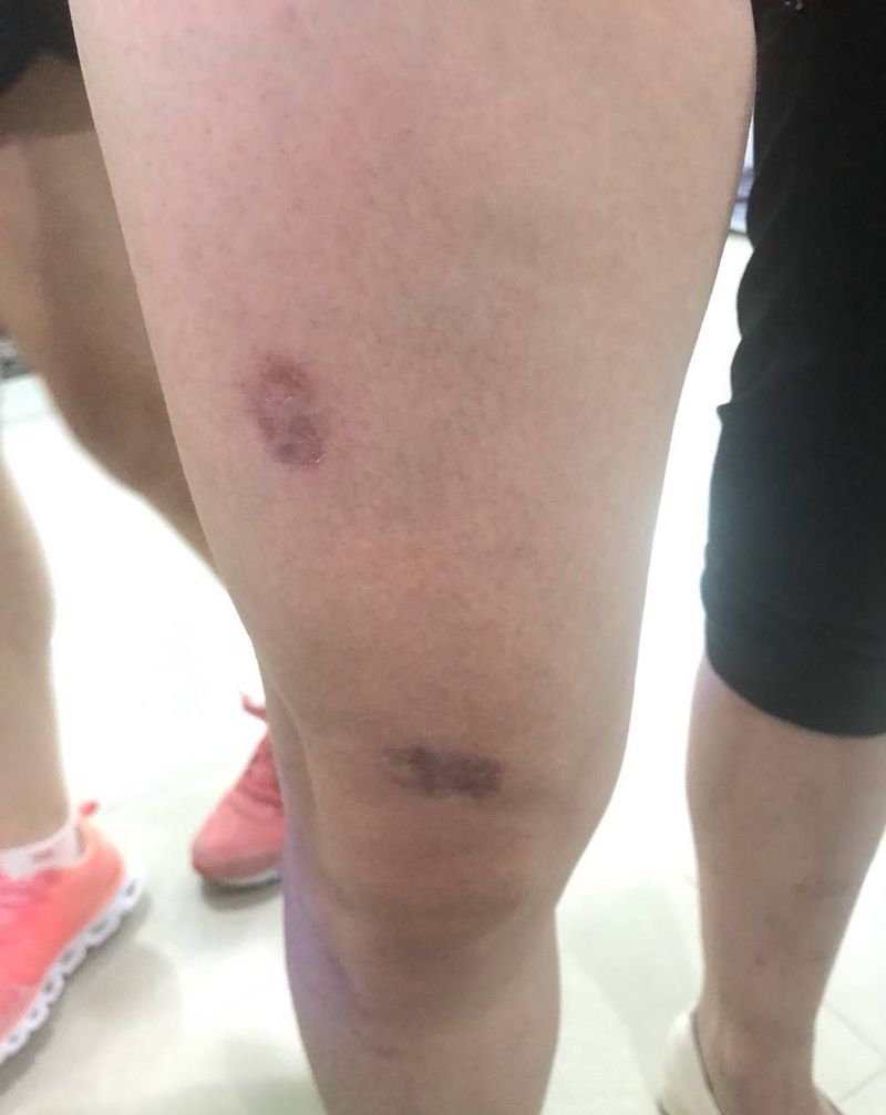 遮盖疤痕纹身图片