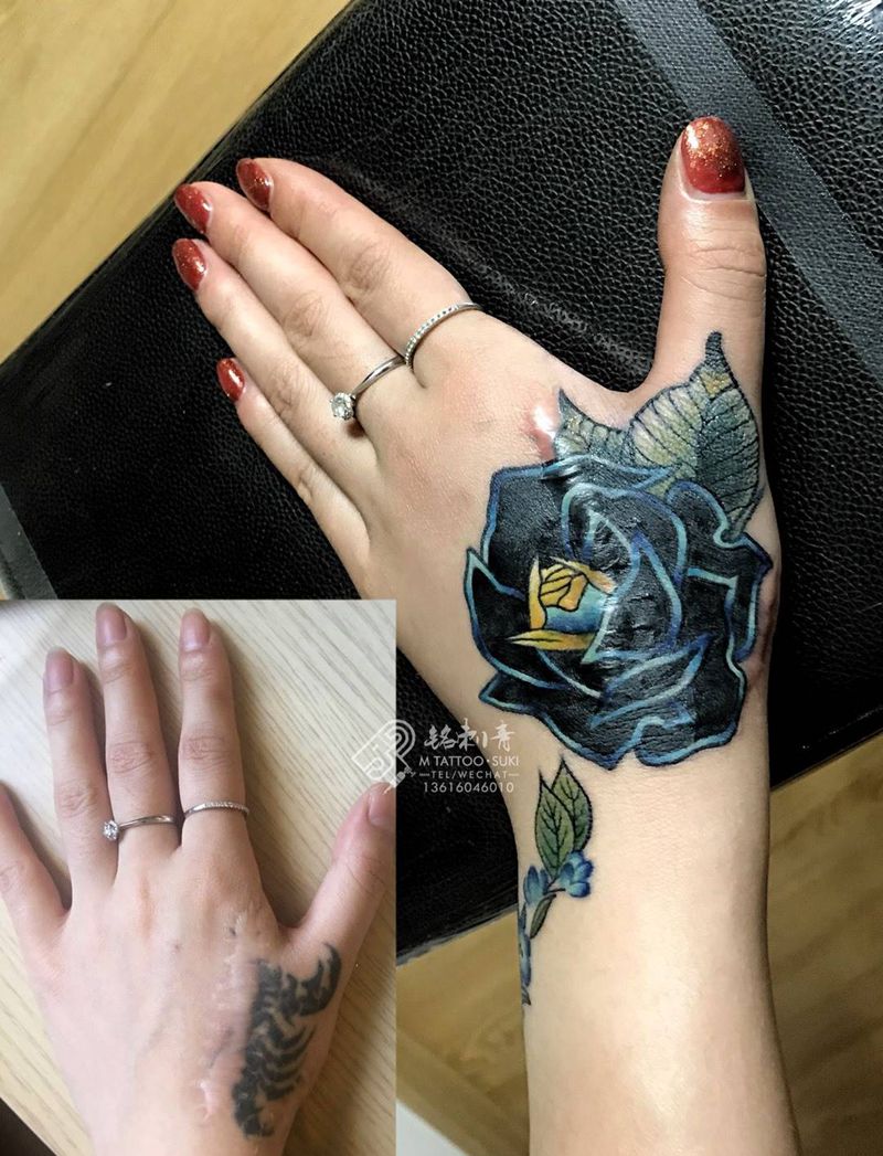遮盖严重疤痕和旧纹身纹身图片