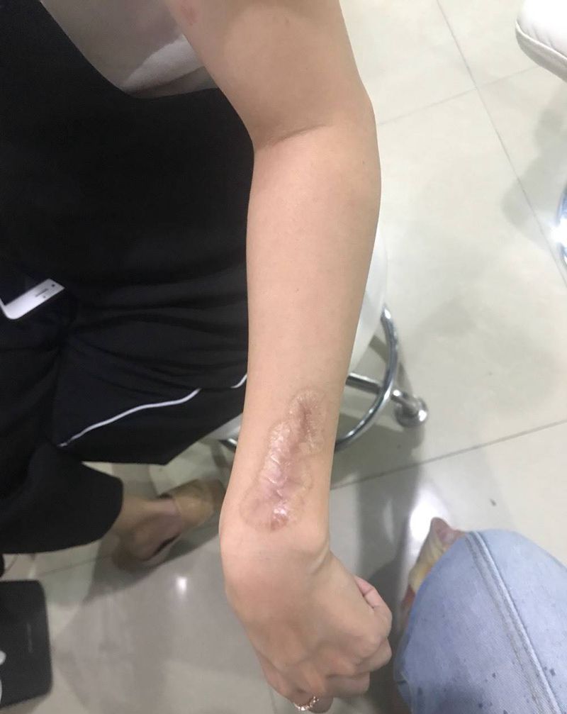 疤痕遮盖纹身图片