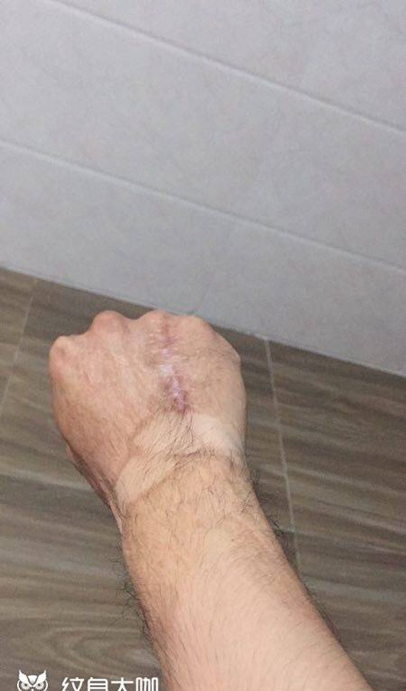 真心不容易,多年的心理阴影一步一步的去除,手背遮盖,秒变时尚达人纹身图片