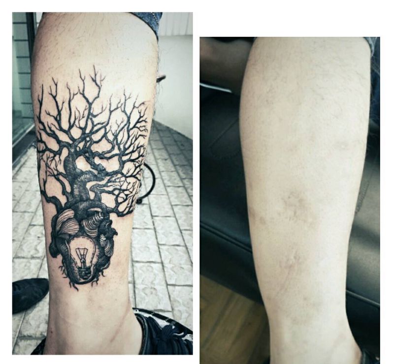 心脏树遮盖疤痕纹身图片_腿部欧美清新写实植物成品纹身图案