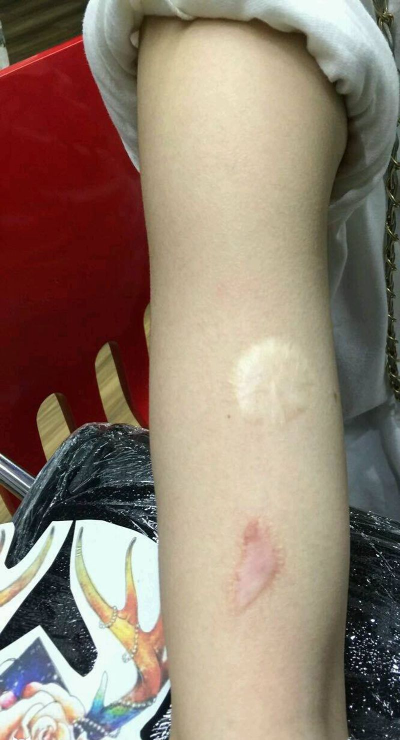 遮盖伤疤纹身图片