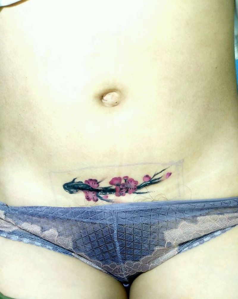 遮盖伤疤纹身图片