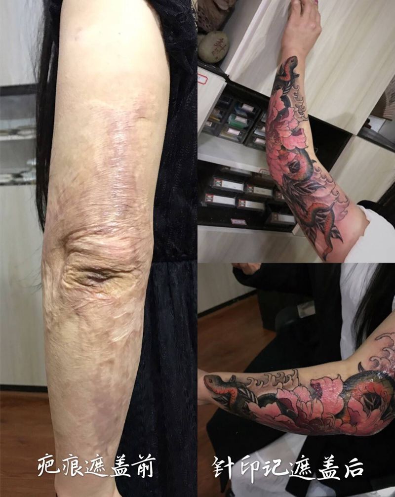 疤痕遮盖纹身图片
