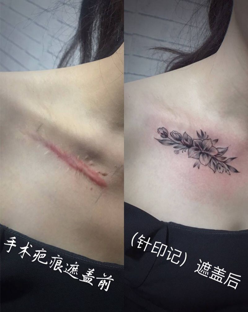 疤痕遮盖纹身图片_花纹身图案