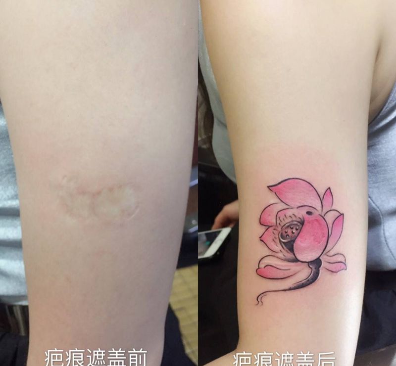 疤痕遮盖纹身图片