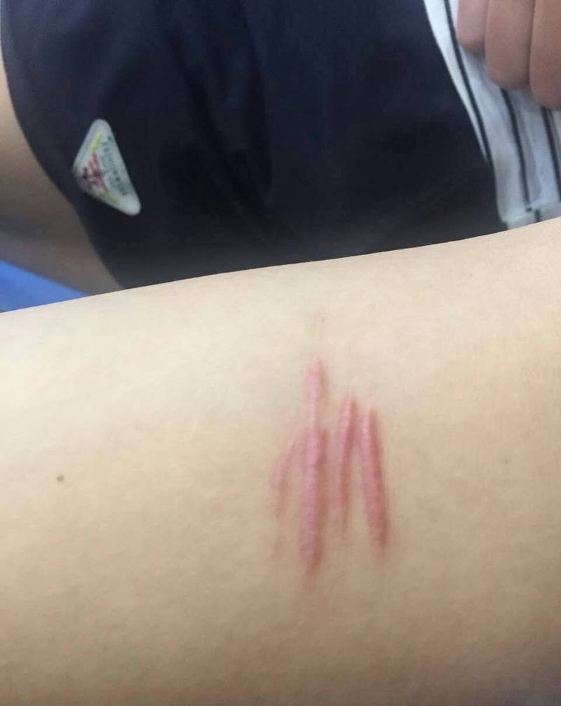 遮盖伤疤前后效果纹身图片