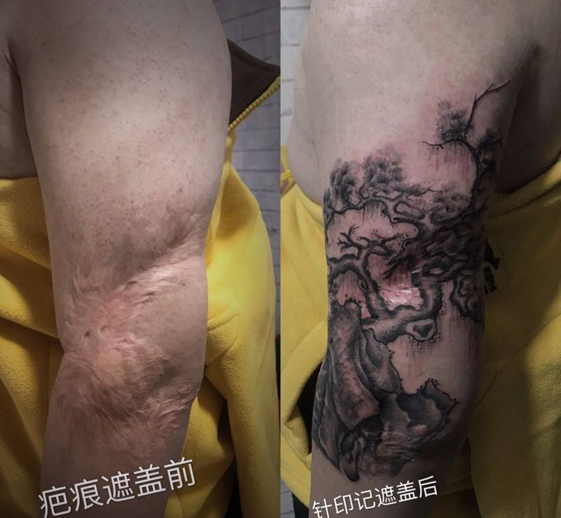 遮盖疤痕作品纹身图片