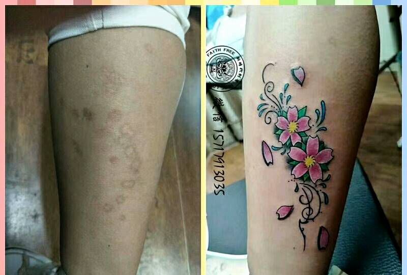 疤痕遮盖纹身图片