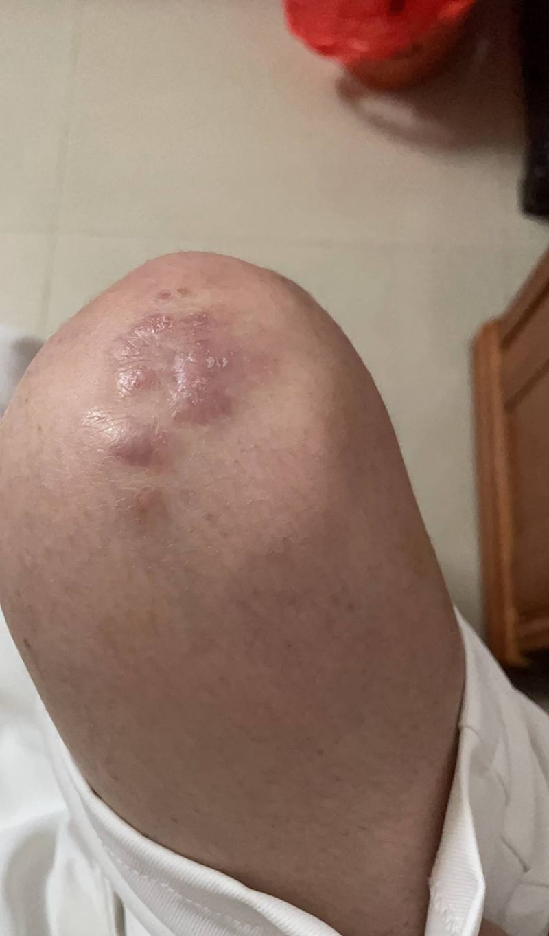 疤痕遮盖素花纹身图片_腿部纹身图案