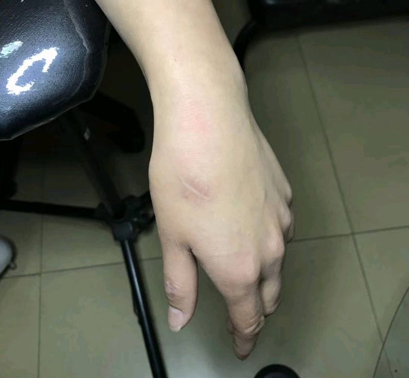 纹身盖疤痕纹身图片