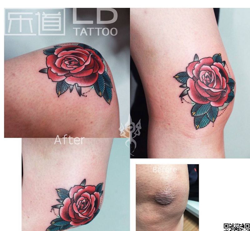 盖疤作品 欧斯够纹身图片_成品手稿手臂腿部欧美植物青岛山东培训背部纹身图案