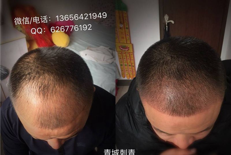 点刺头发纹身图片_点刺纹身图案