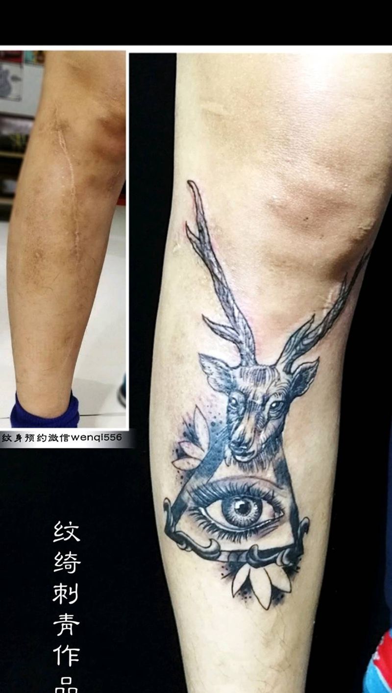 遮盖疤痕纹身图片