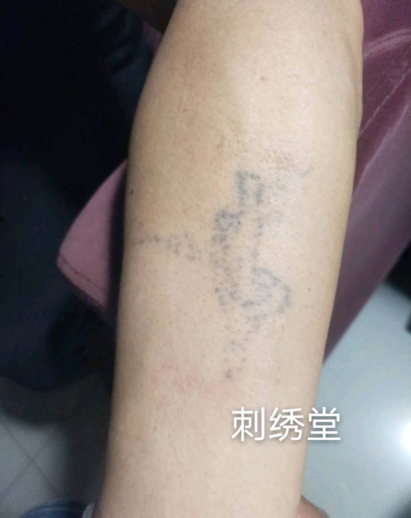 无疤痕祛纹身纹身图片_手臂纹身图案