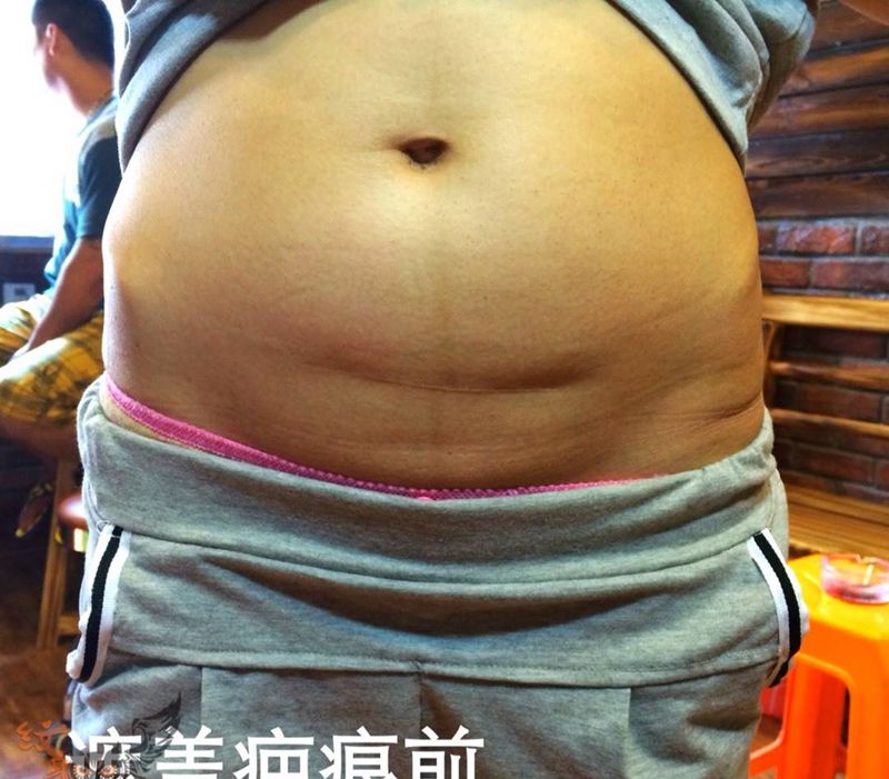 疤痕遮盖纹身图片_腹部传统植物成品纹身图案