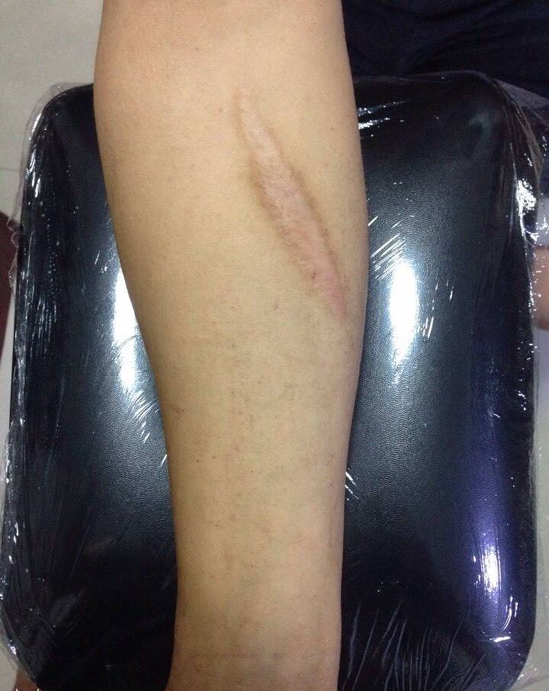 小臂遮盖纹身图片_手臂动物纹身图案