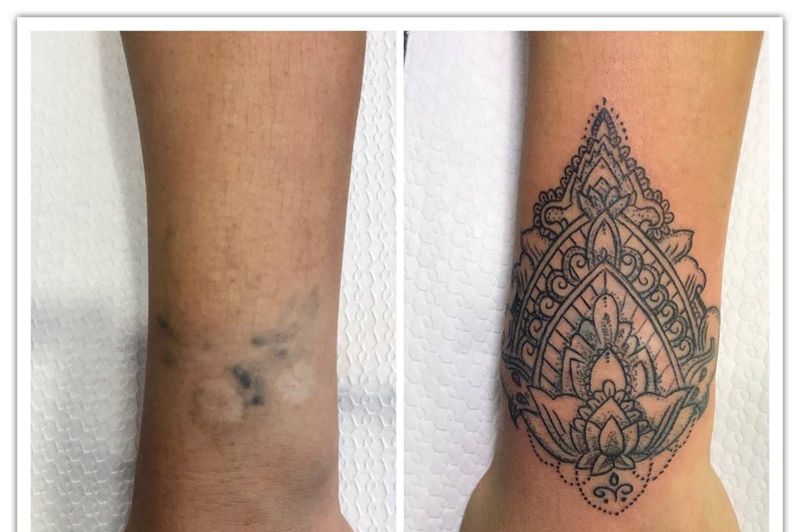 小臂疤痕遮盖纹身图片