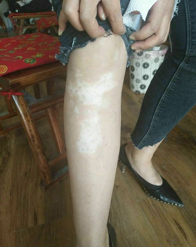 白癜风遮盖纹身图片_腿部欧美静物成品纹身图案