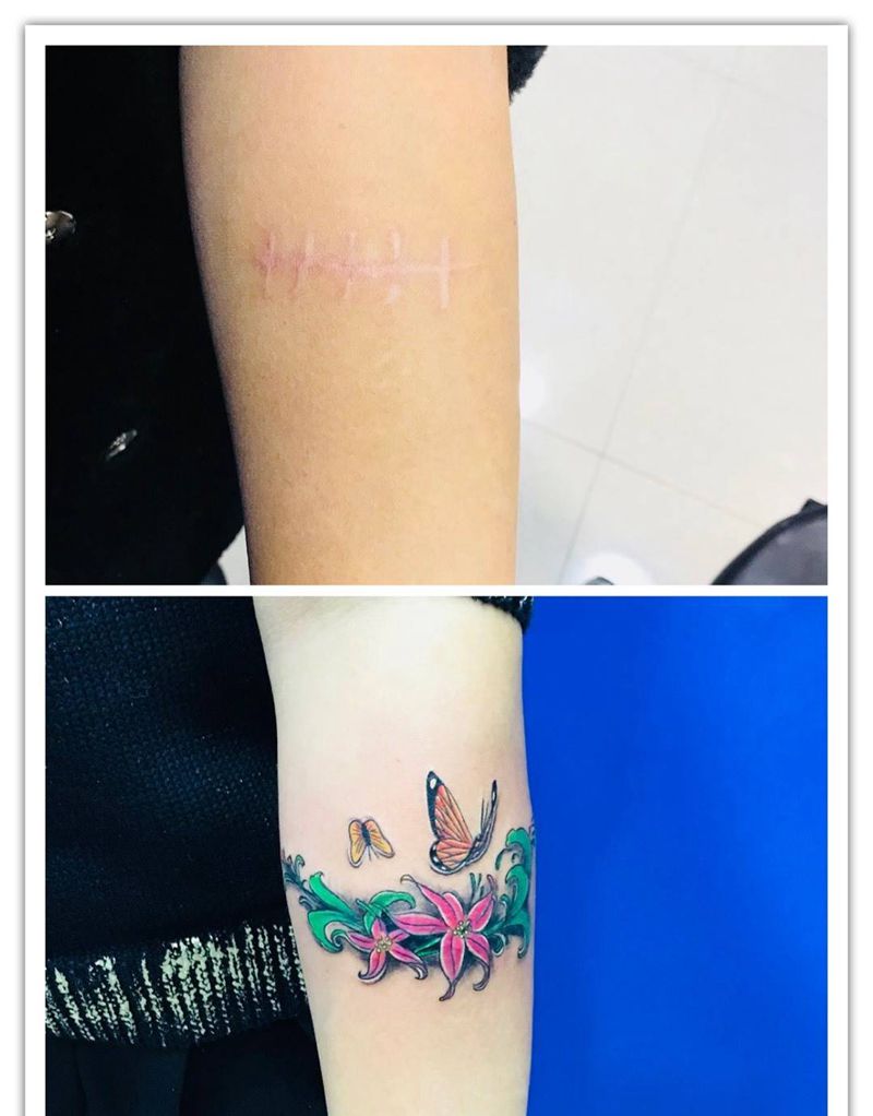 疤痕遮盖纹身图片_成品手臂清新植物纹身图案