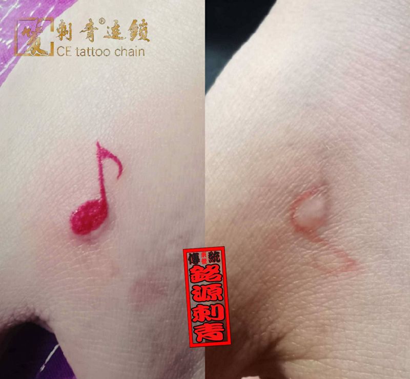 一位钢琴老师的小小疤痕遮盖纹身图片_手部纹身图案