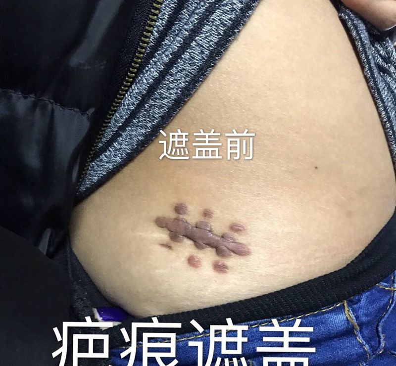 疤痕遮盖纹身图片