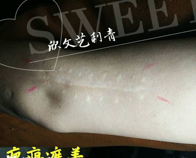 疤痕遮盖《欣师傅作品》纹身图片