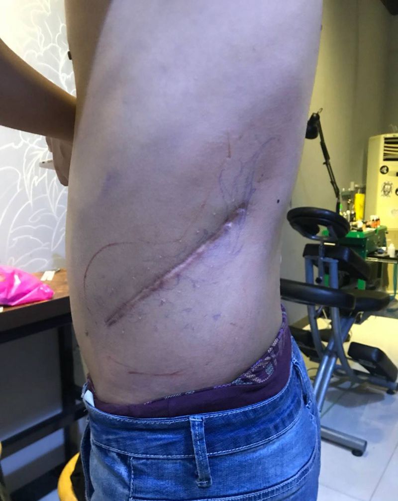 疤痕遮盖。纹身图片