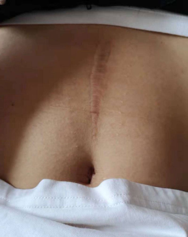 抛妇产伤疤遮盖纹身图片