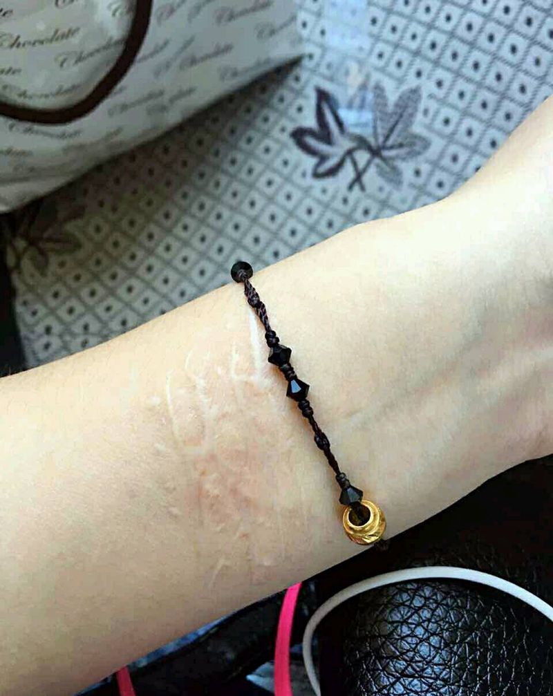 疤痕遮盖纹身图片