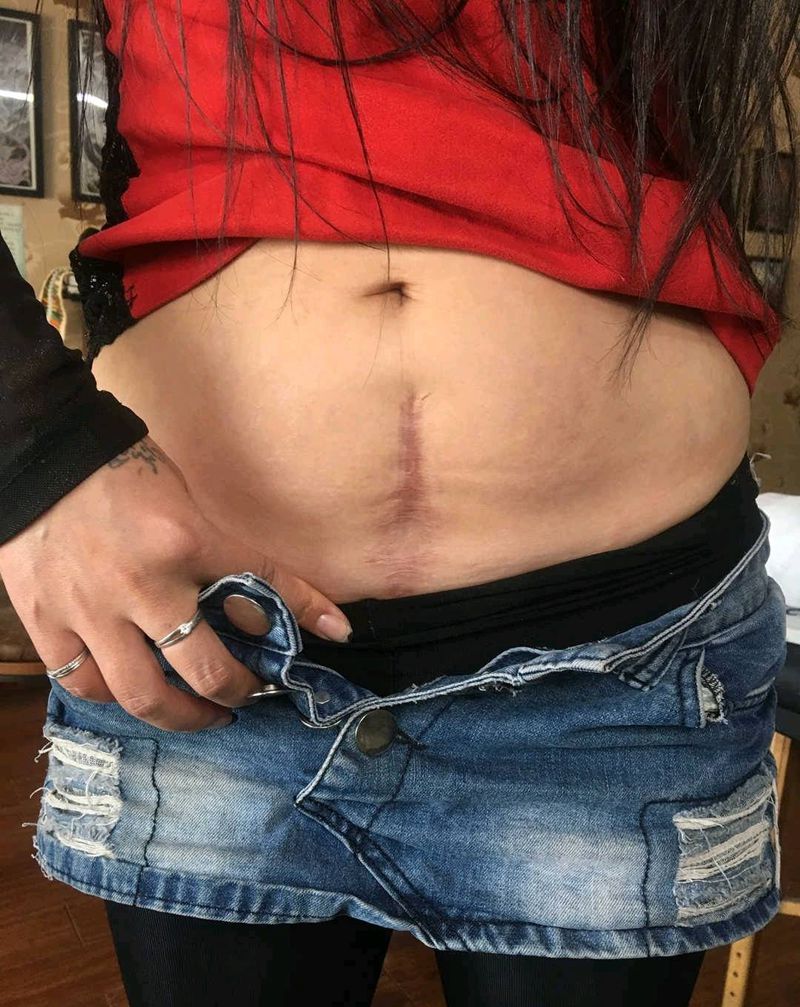 剖腹产遮盖纹身图片_腹部新传统纹身图案
