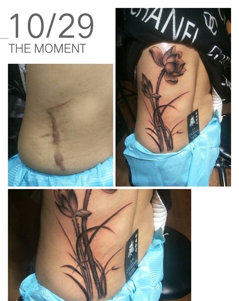 遮盖手术疤纹身图片