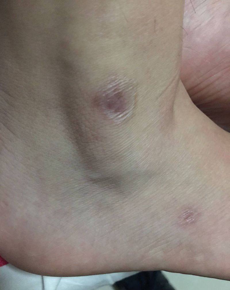 疤痕遮盖纹身图片