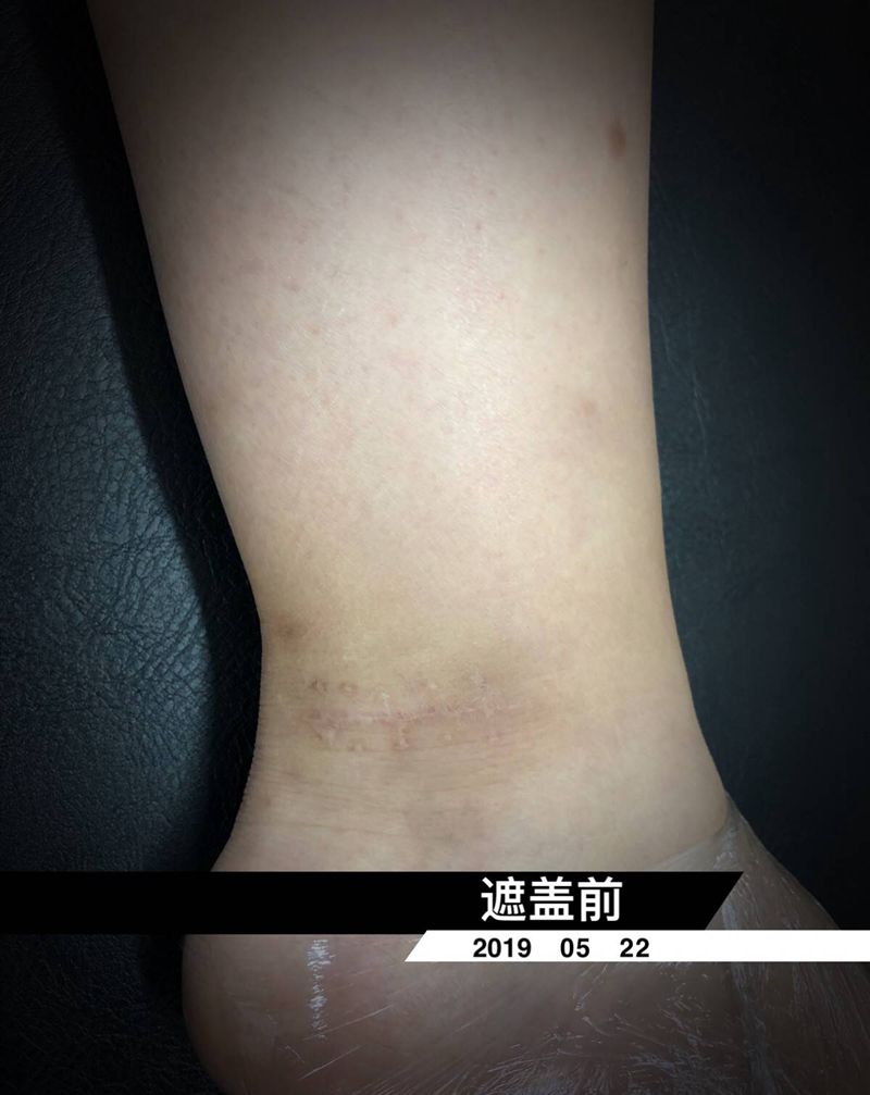 遮盖伤疤纹身图片_小鱼纹身图案