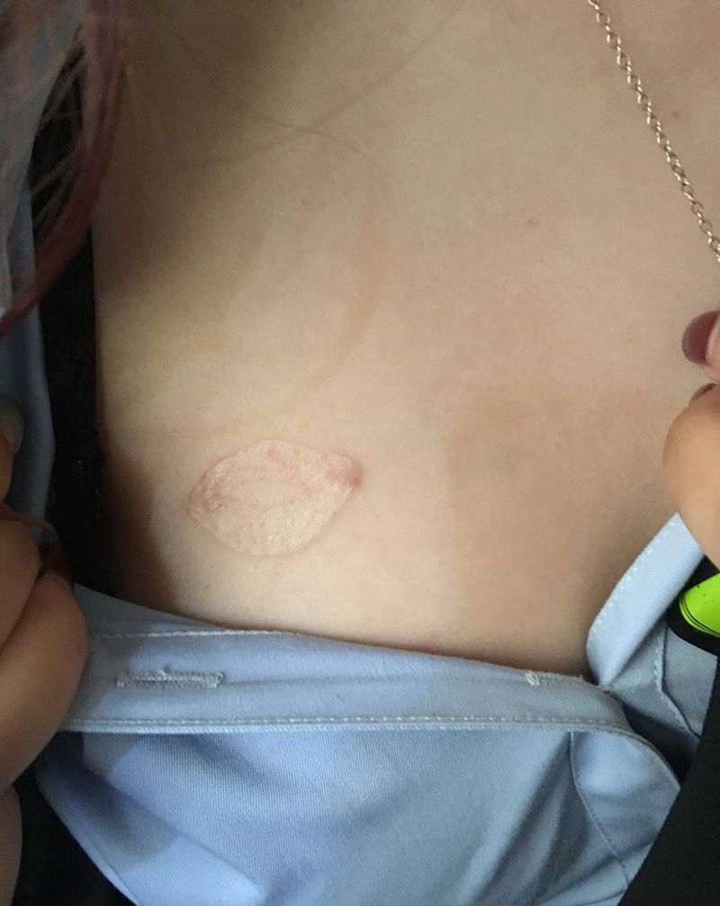 贝壳，伤疤遮盖纹身图片