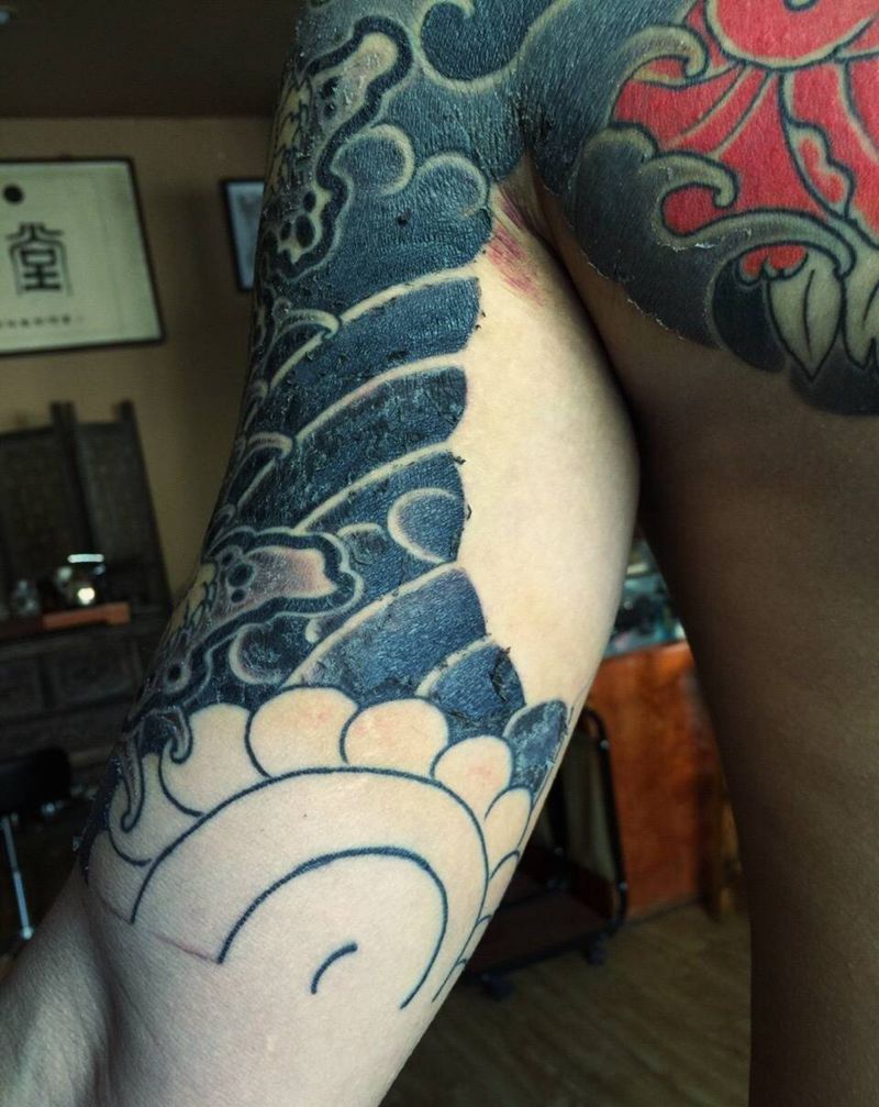 恢复第四天爆皮～