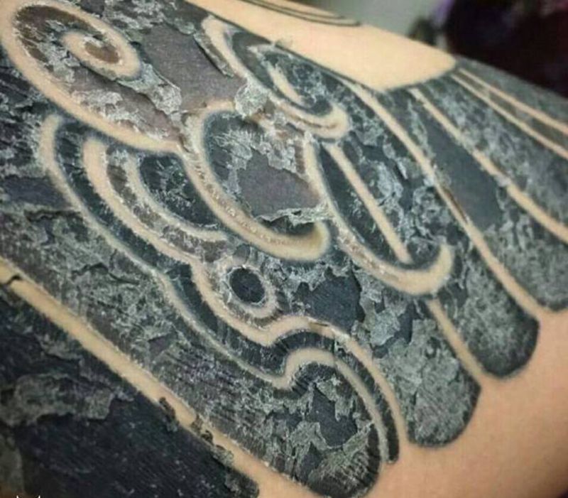 治疗强迫症～纹身图片