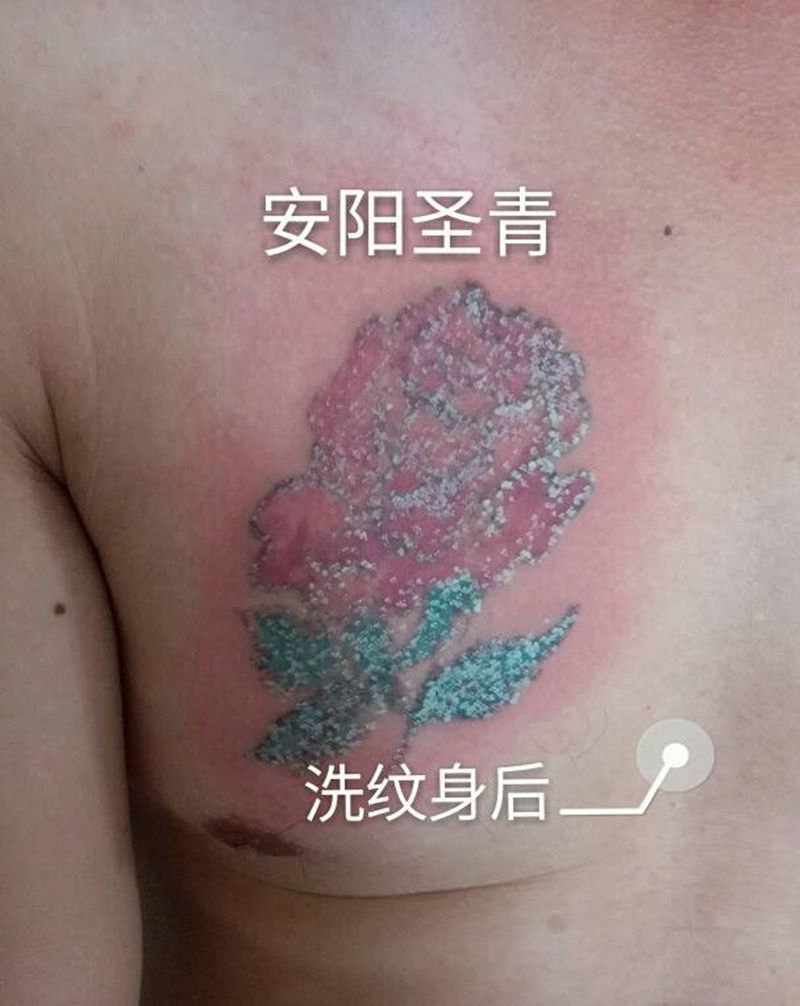 洗纹身图片