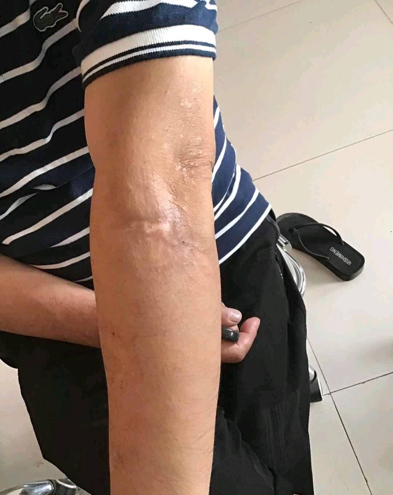 鱼遮盖纹身图片_手臂新传统纹身图案