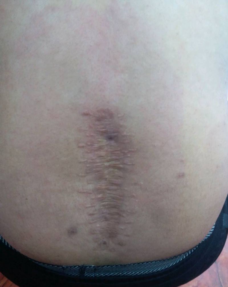 遮盖疤痕完成需要遮盖的可以约起纹身图片