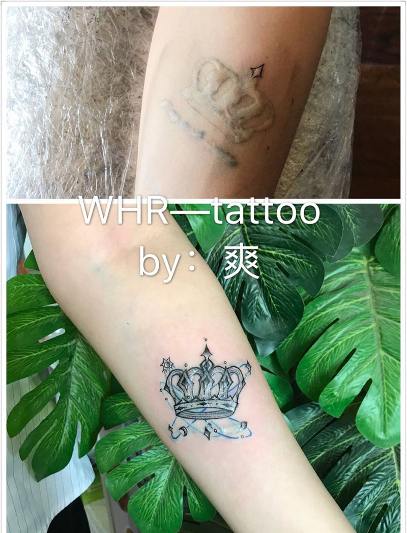 原图遮盖疤痕纹身图片_手臂水彩纹身图案