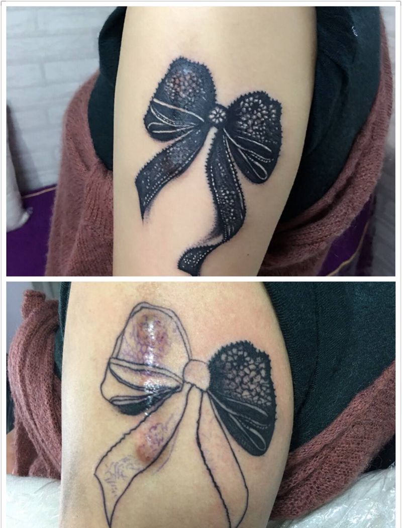 遮疤痕盖纹身图片