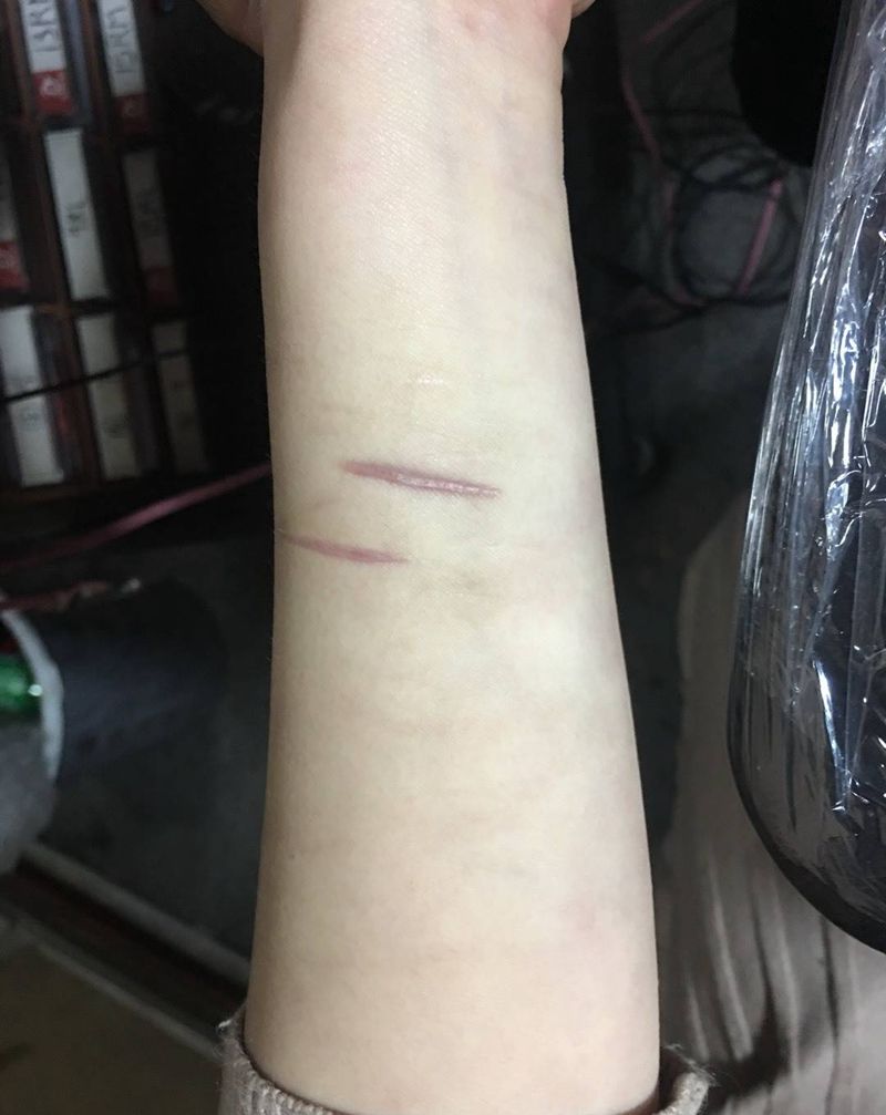 疤痕遮盖纹身图片