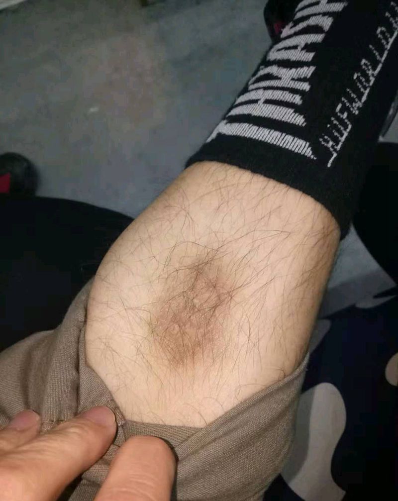 遮盖伤疤纹身图片