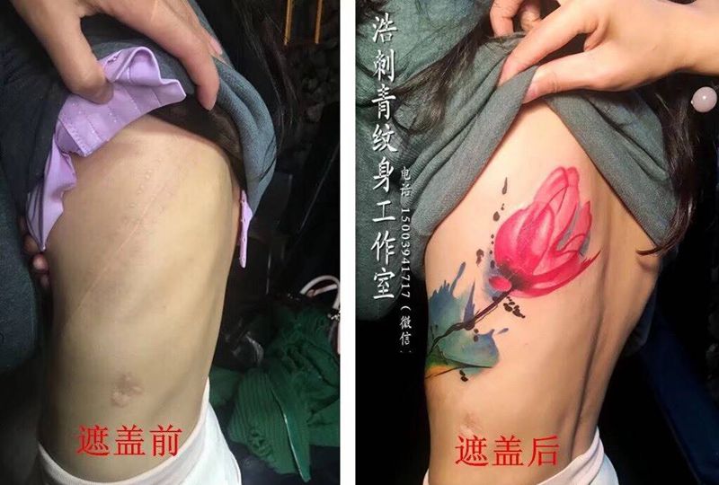 罂粟遮盖伤疤纹身图片