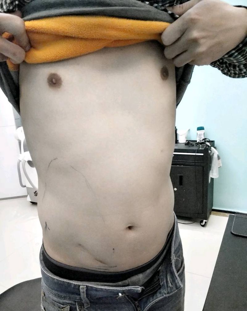 遮盖鲤鱼未完纹身图片