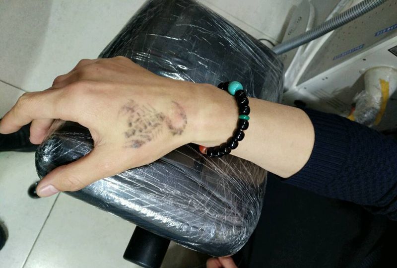 虎口蝎子清洗纹身图片_手部传统动物原创花絮生活成品纹身图案