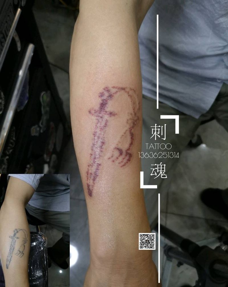 祛除旧纹身纹身图片_手臂祛除旧纹身图案