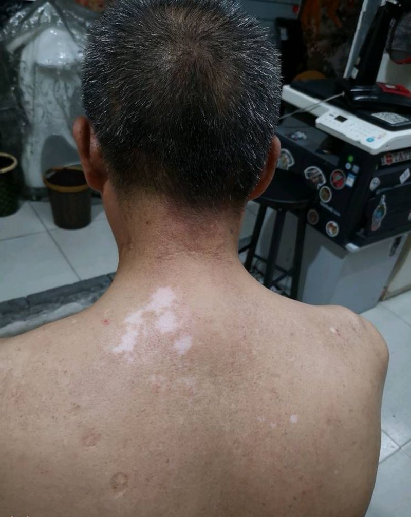 遮盖白癜癍纹身图片_背部传统习俗原创成品手稿插画纹身图案